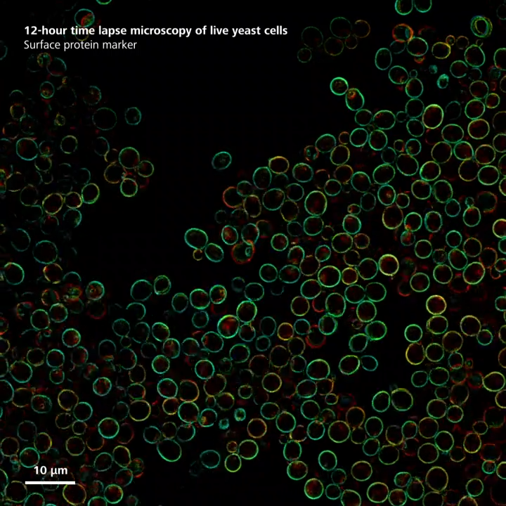 Yeast - Endosomes | Lattice SIM