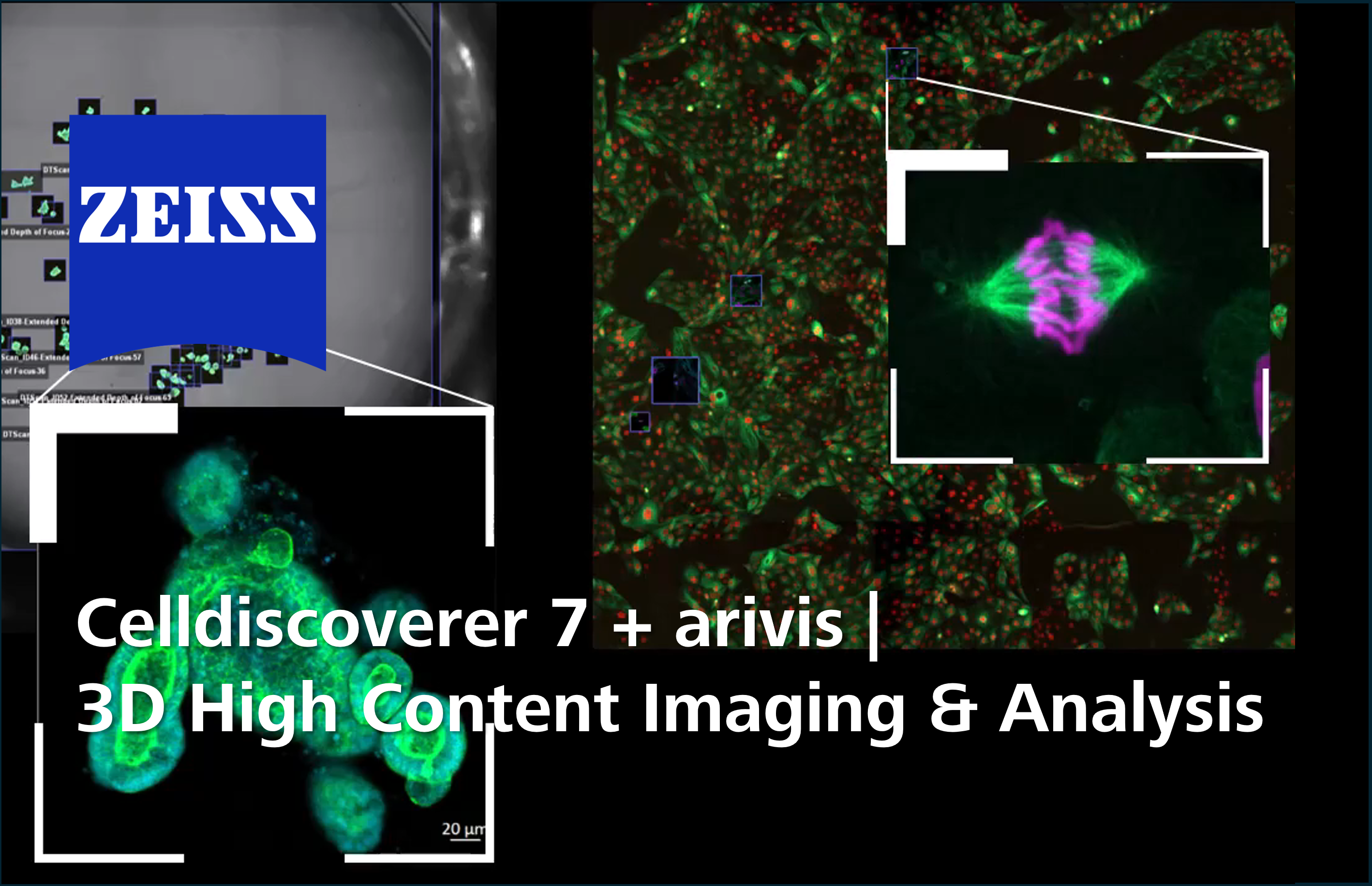 3D High Content Imaging and Analysis Webinar: June 2025