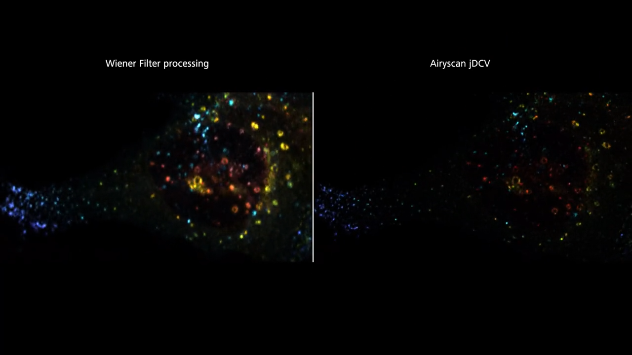 Cos7 - Endosomes | Airyscan
