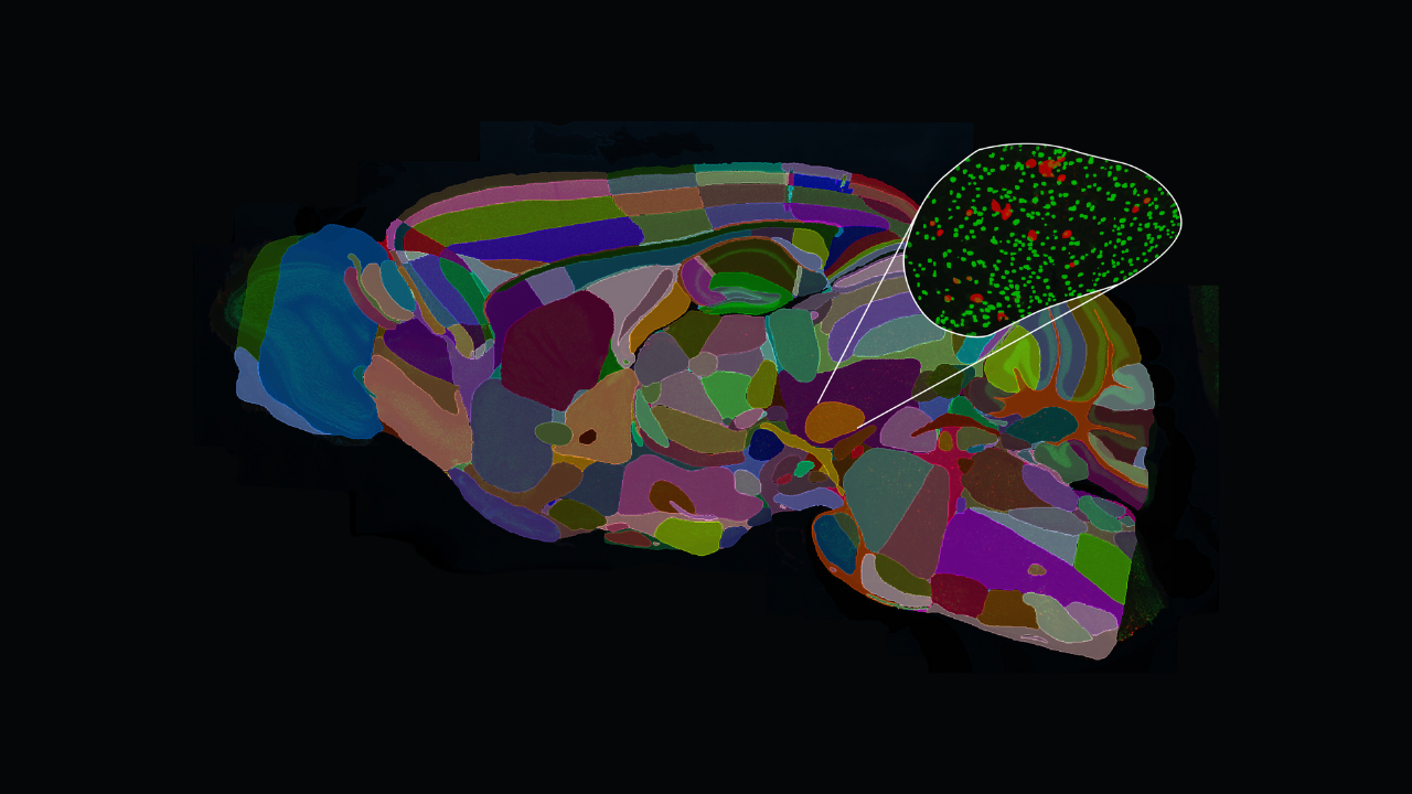 Brainsight Breakthroughs: Tauopathy and Atlas Registration