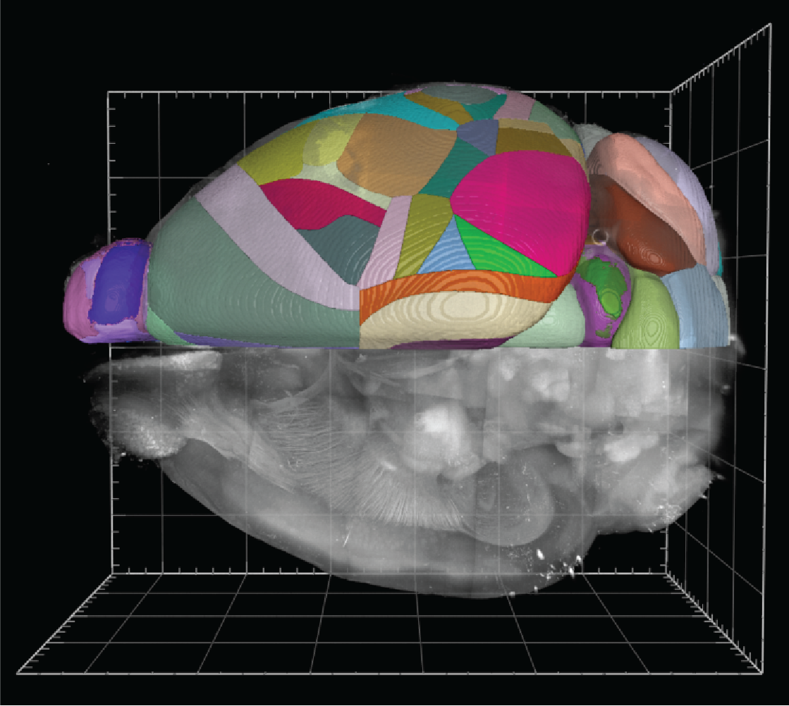 Brainsight Breakthroughs: TBI and Cleared Brain Registration