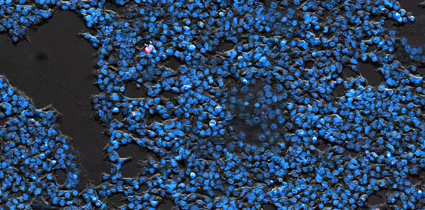 HEK293 - Cytosolic | Widefield