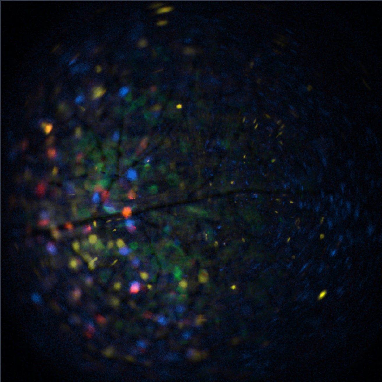 Brainsight Breakthroughs: MultiColor in vivo imaging