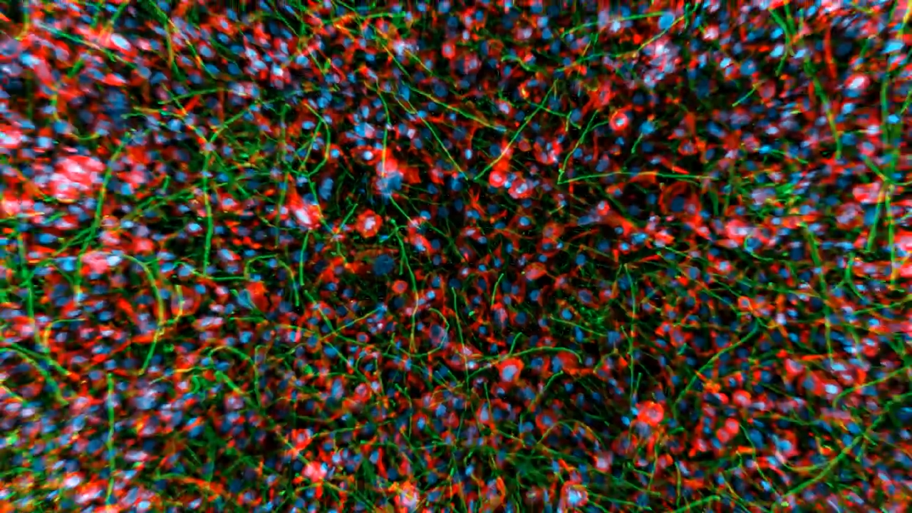 Fungal_Infection_Epithelium | LF4D
