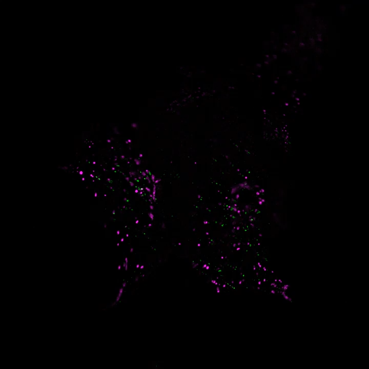 U2Os - Golgi + Endosomes | Lattice SIM