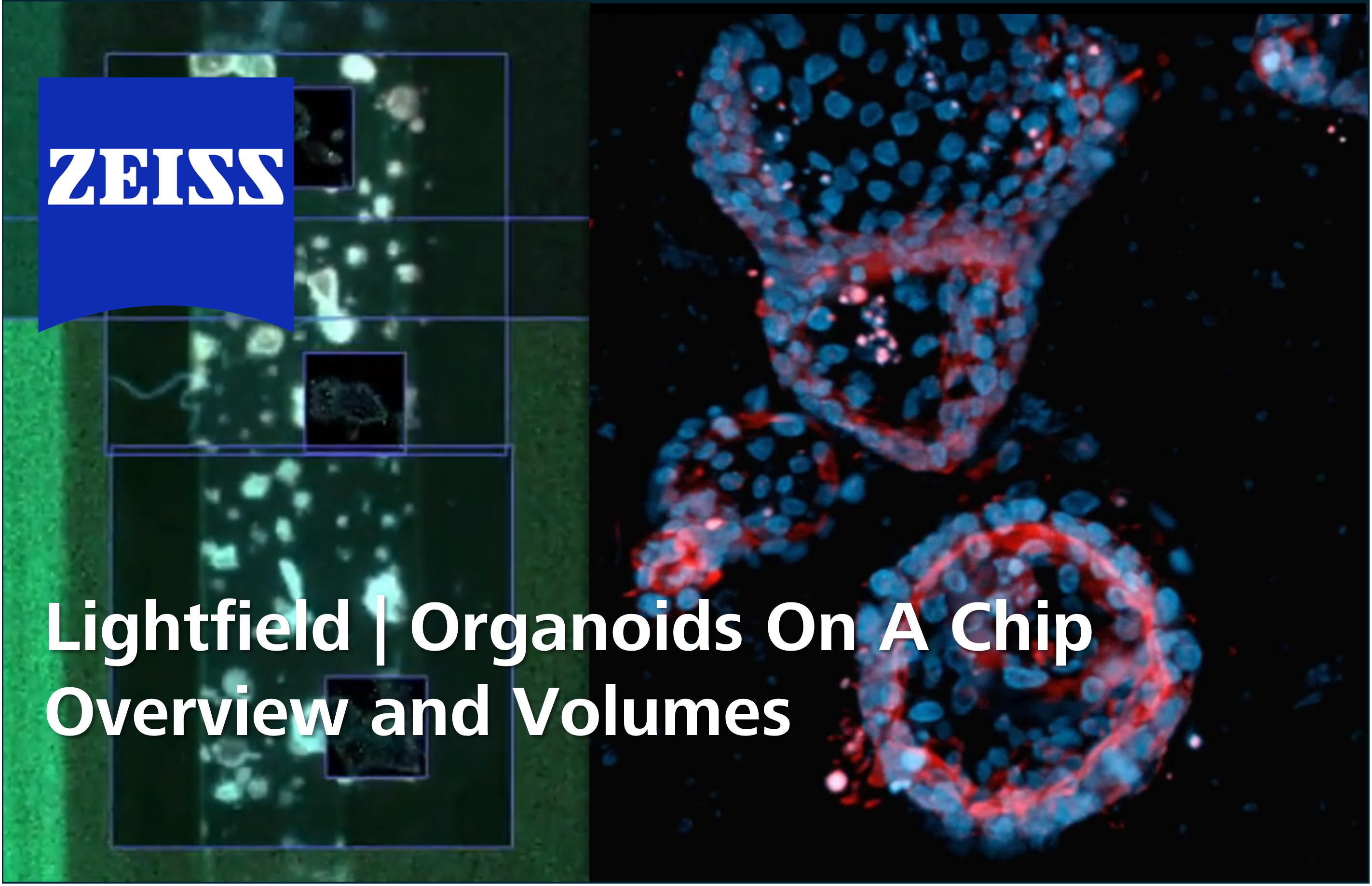Organoids on a Chip Overview and Volumes