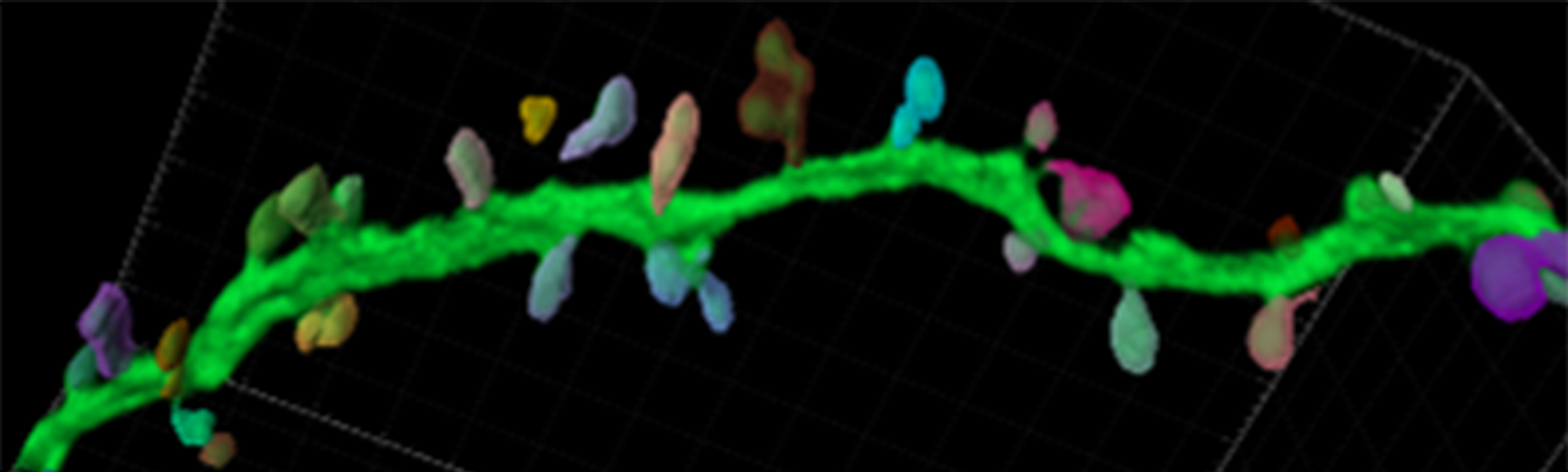 Brainsight Breakthroughs: Dendritic Spines