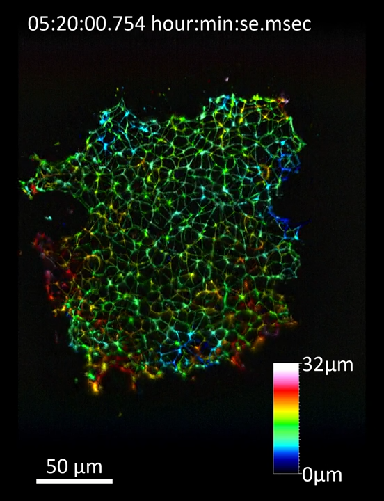 Stem Cell Colonies | LLS7
