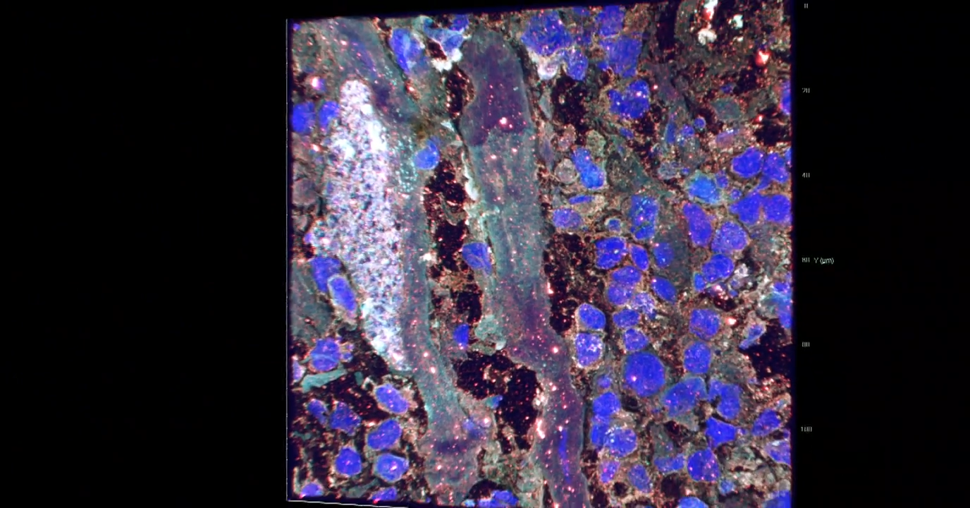 Trypanosoma Infection | Widefield