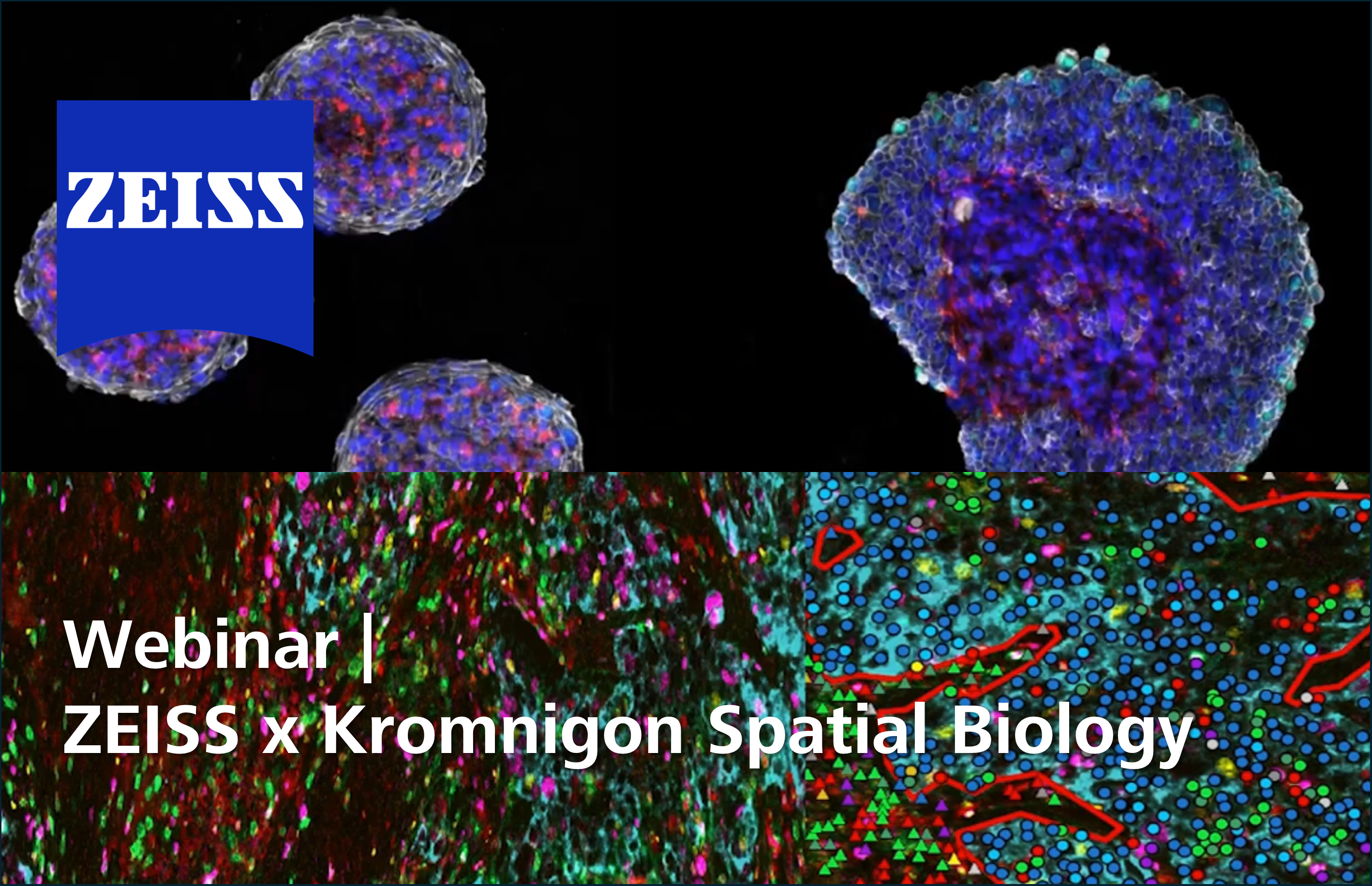 Unraveling the Tumor Microenvironment with ZEISS Spatial Biology Workflow Webinar