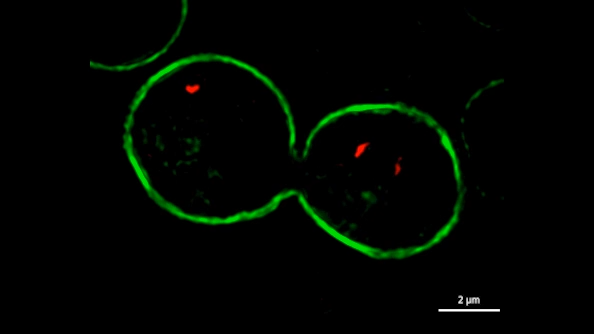 Yeast - Membrane + Golgi | Lattice SIM
