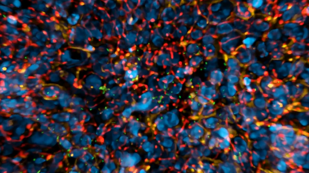 Bacteria-infection_Intestine | LF4D